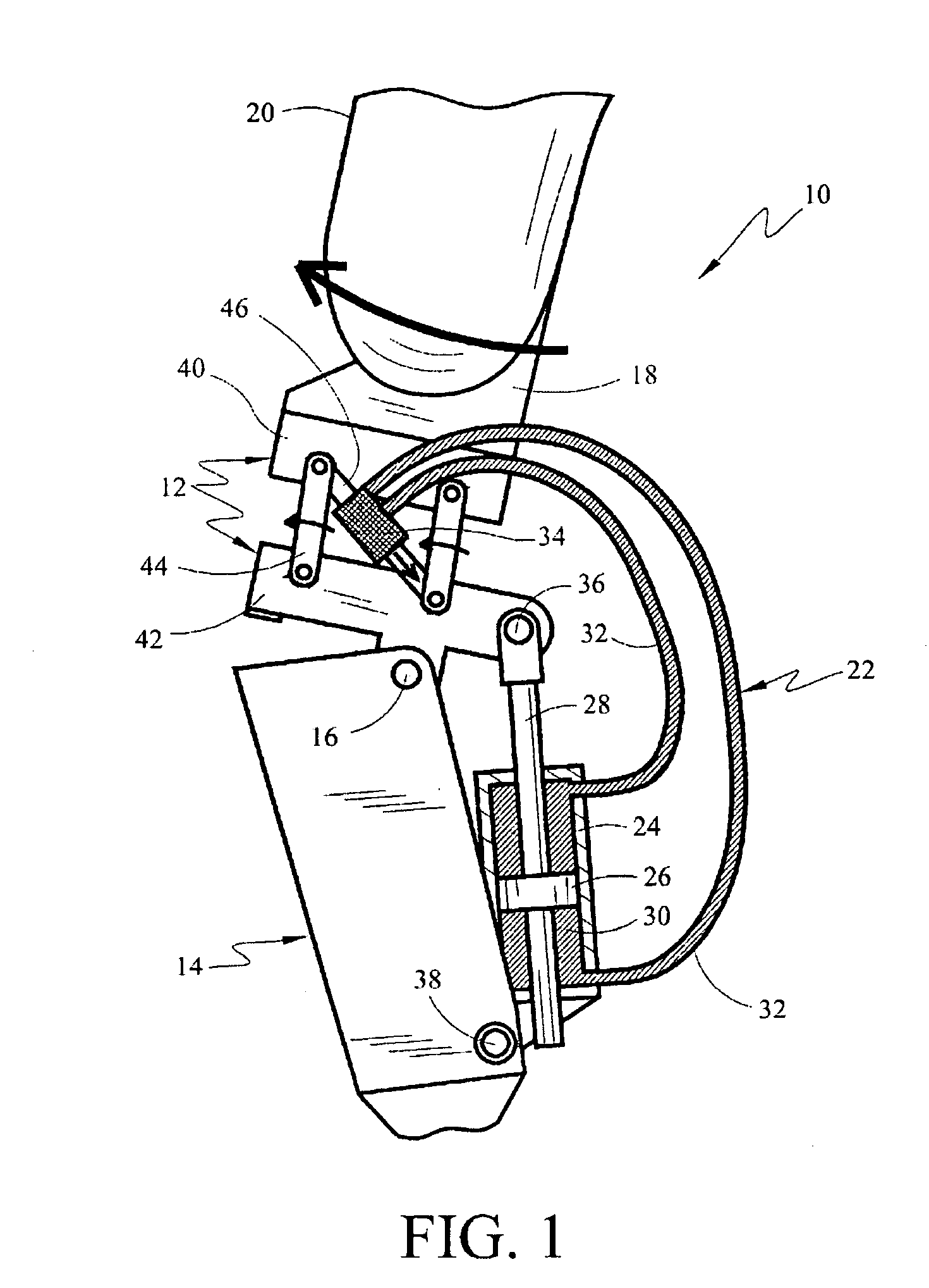 Above-knee prosthesis with variable resistance knee joint