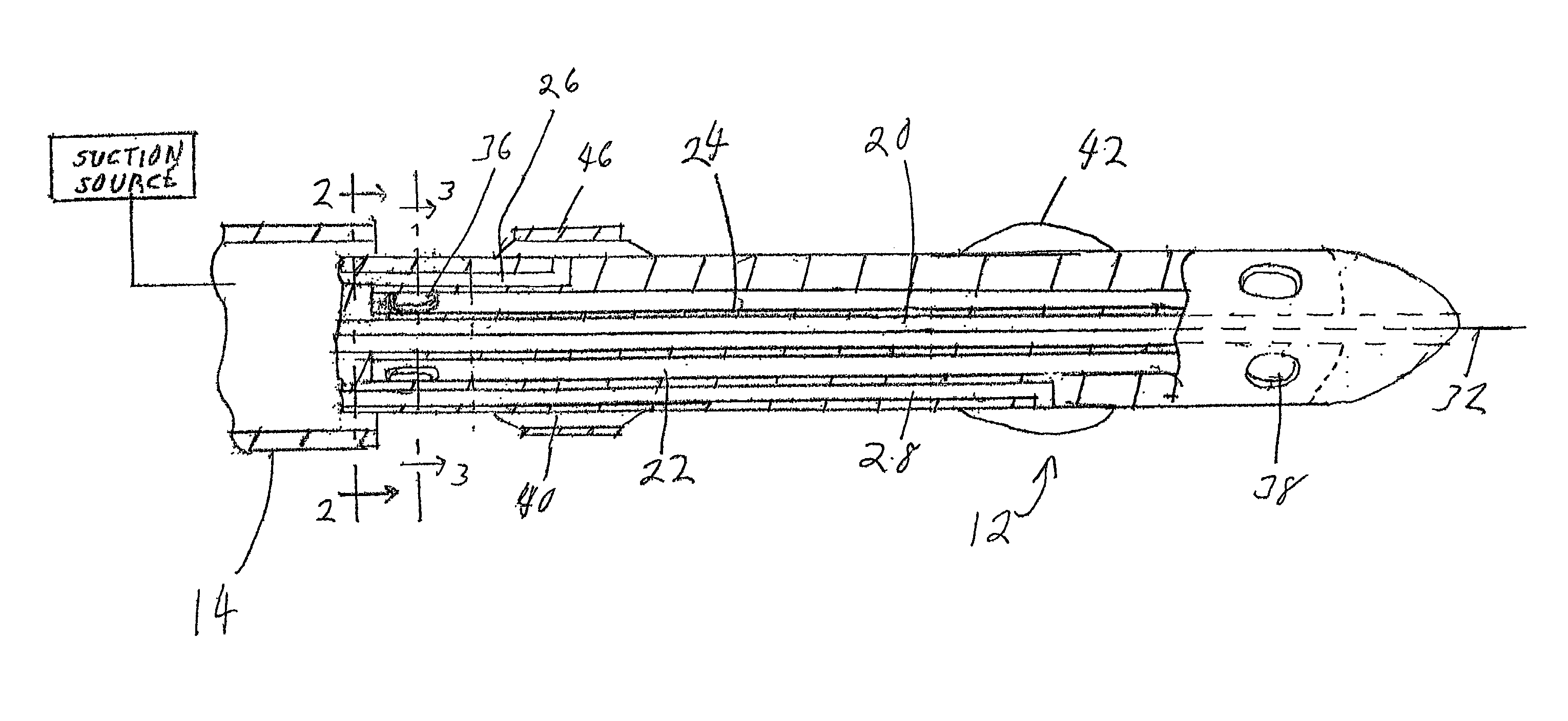 Distal protection double balloon catheter