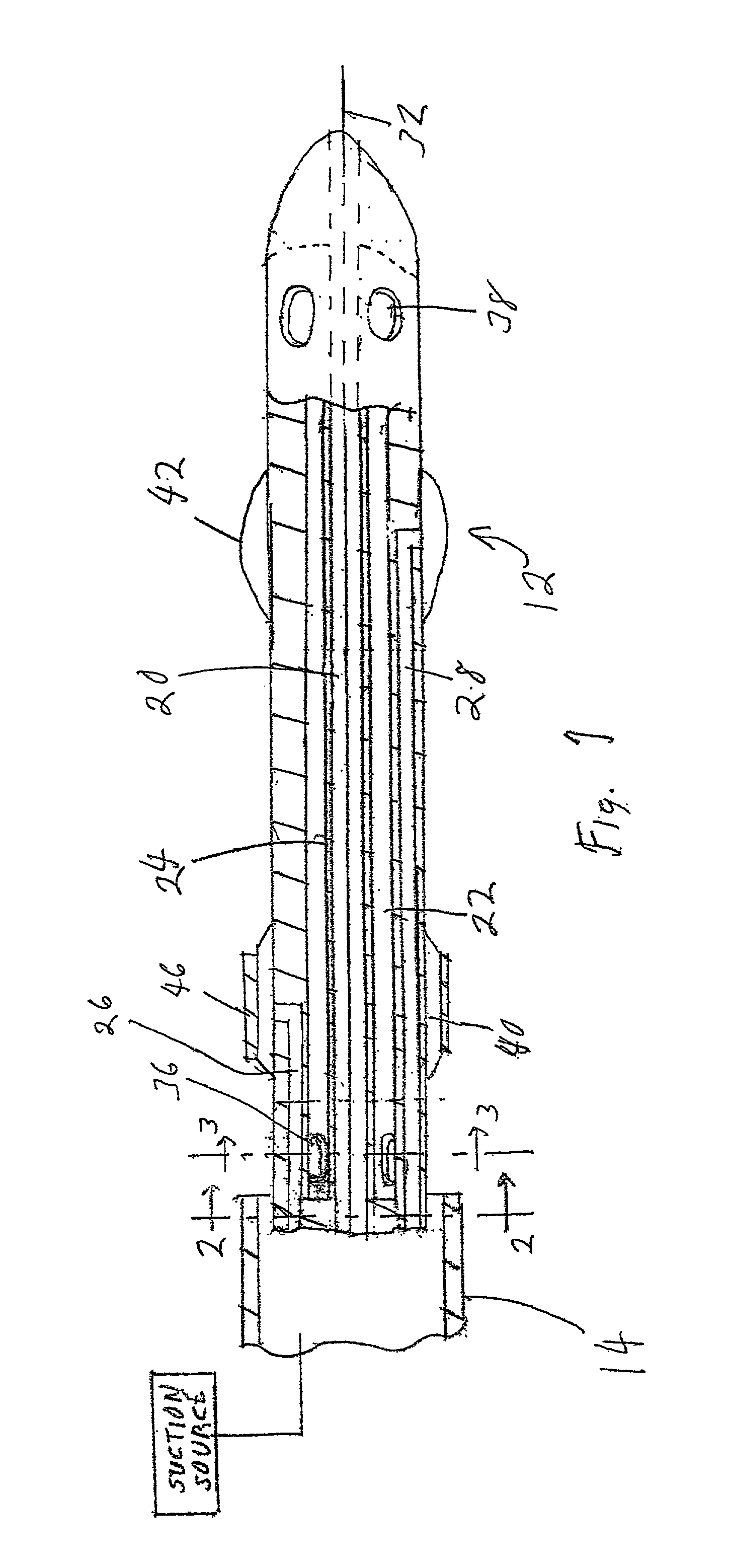 Distal protection double balloon catheter