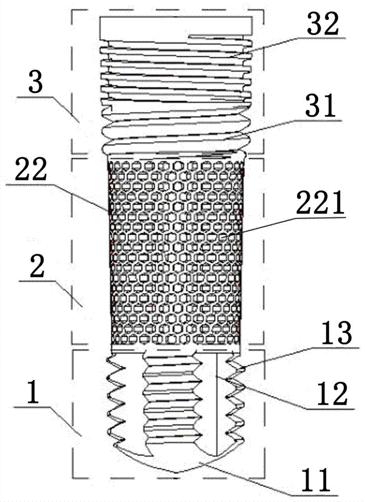 3D printed fang implant with multisection structure