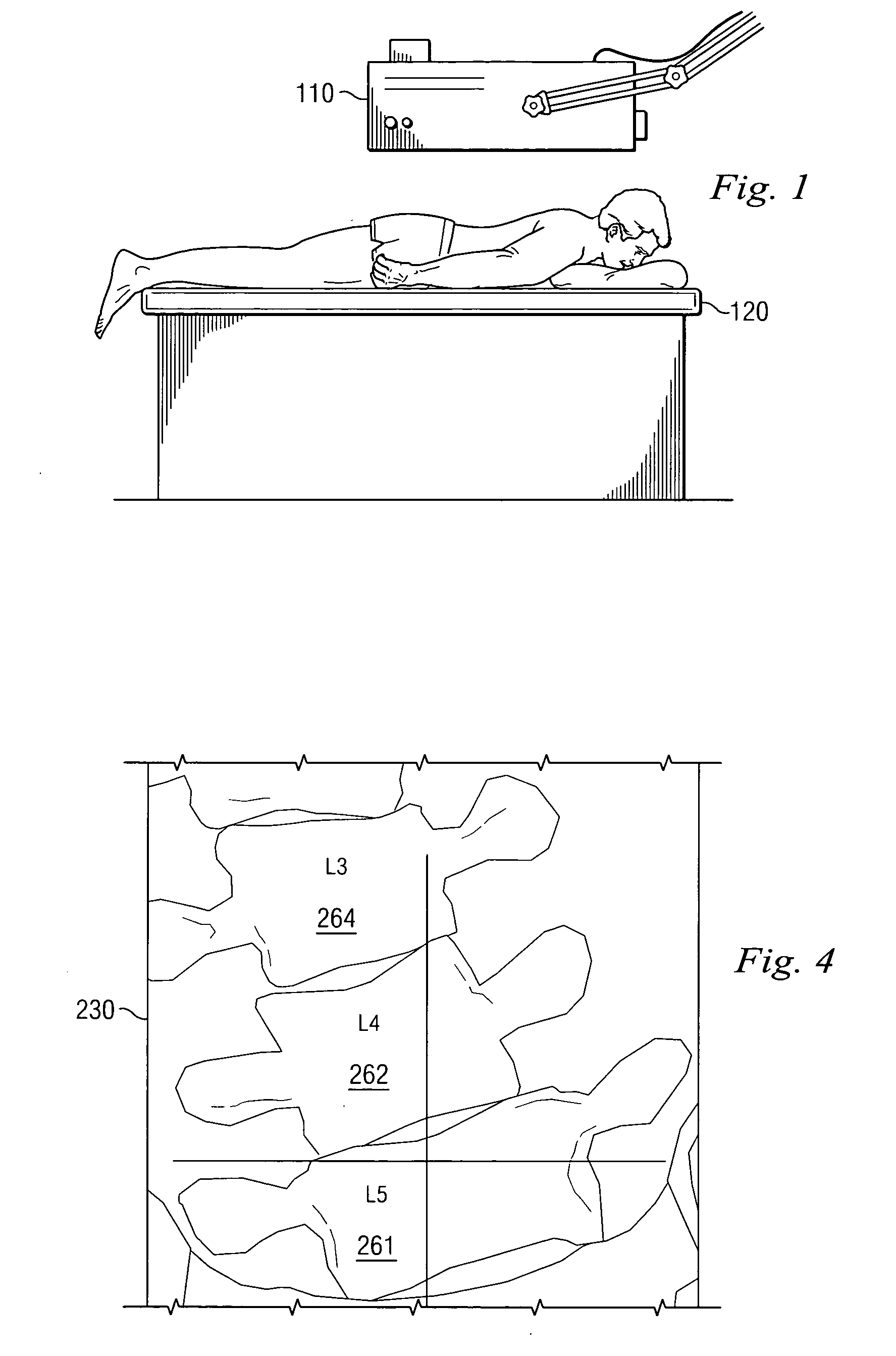 System and method of mapping images of the spine