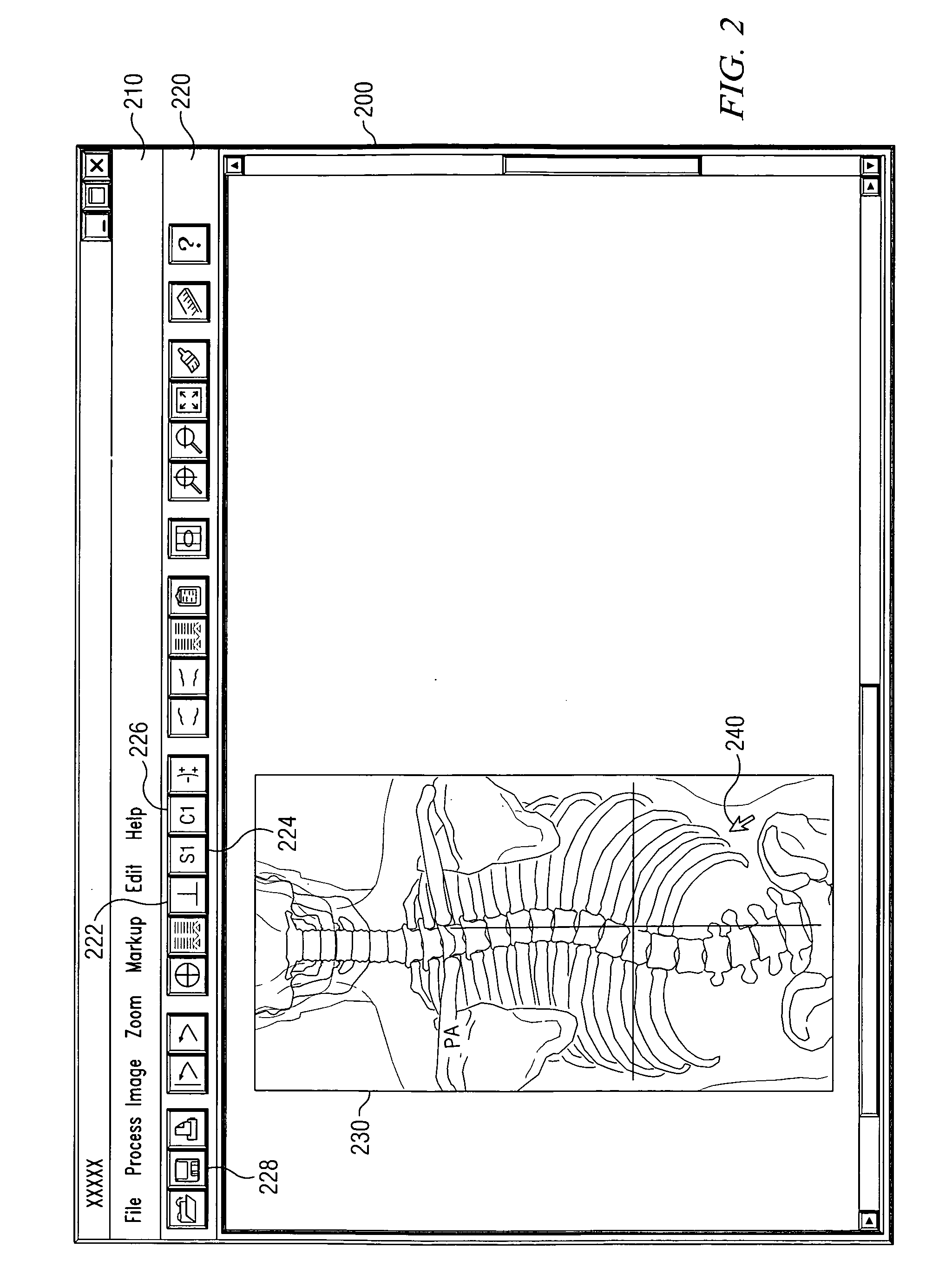 System and method of mapping images of the spine