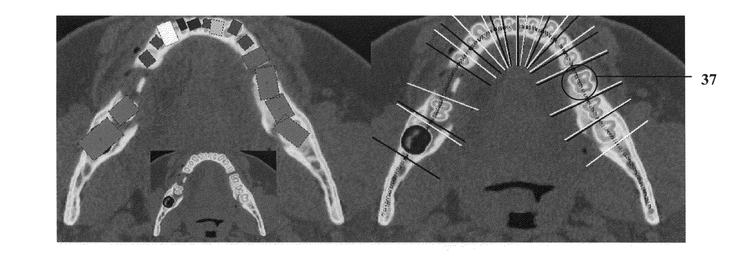 Method for (semi-) automatic dental implant planning