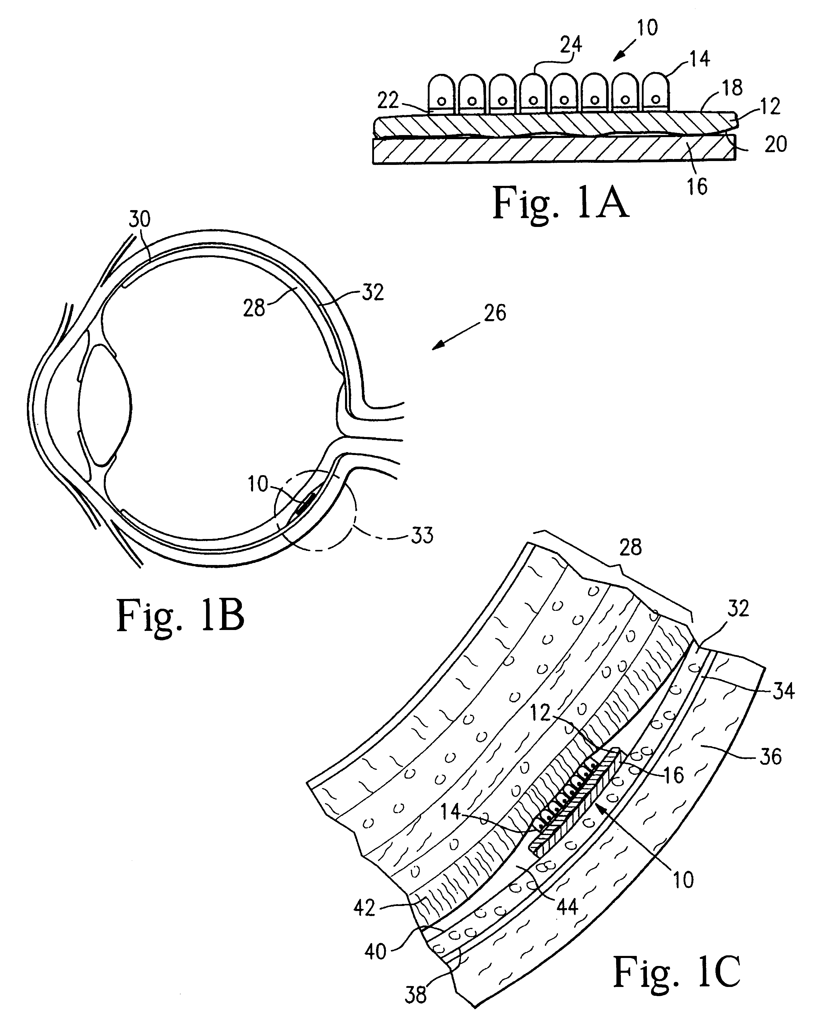 Microfabricated tissue as a substrate for pigment epithelium transplantation