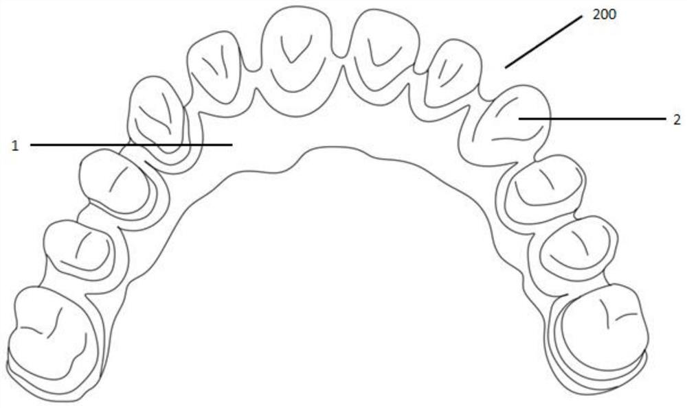 Preparation method of 3Y-TZP ceramic paste and preparation process of complete-implant fixed prosthesis