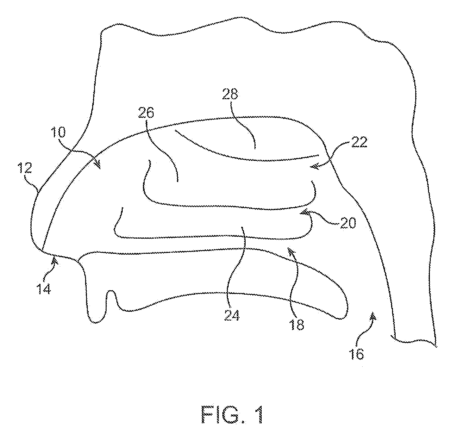 Apparatus and methods for treatment of nasal tissue