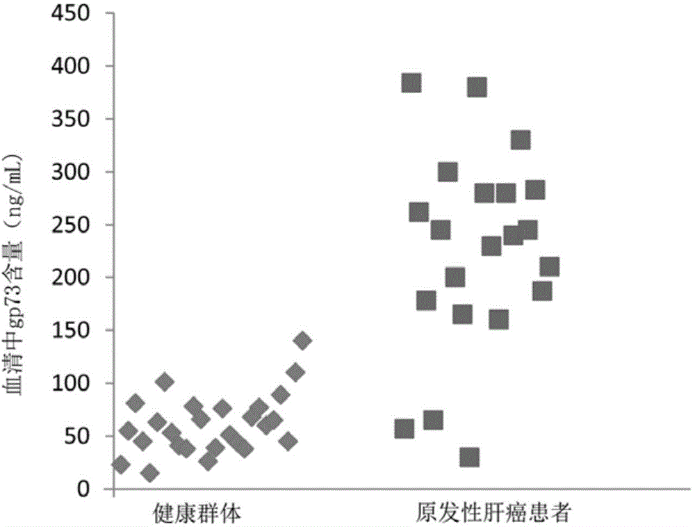 Latex-enhanced immunoturbidimetry detection kit of Golgi protein gp73 and preparation method thereof