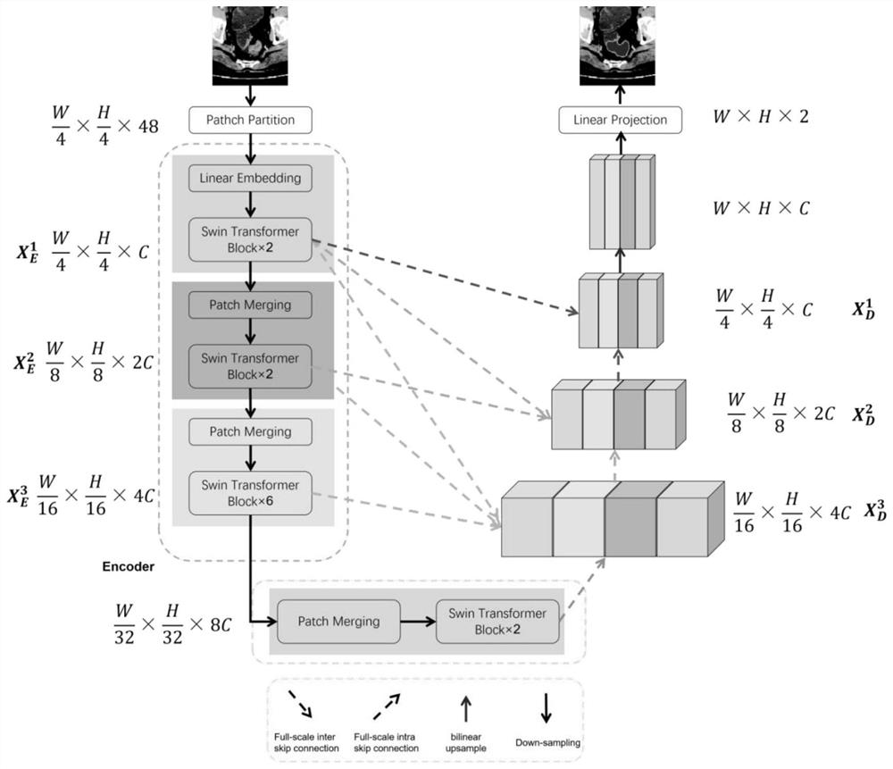 Automatic segmentation method for rectal cancer CT image based on U-Transformer