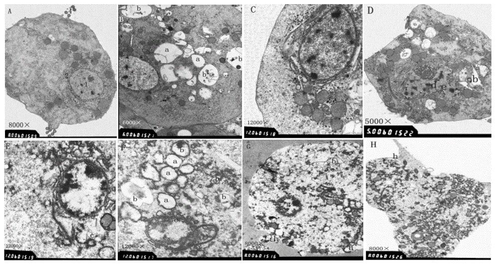 Application of patchouli oil in preparation of medicines used for treating colpitis