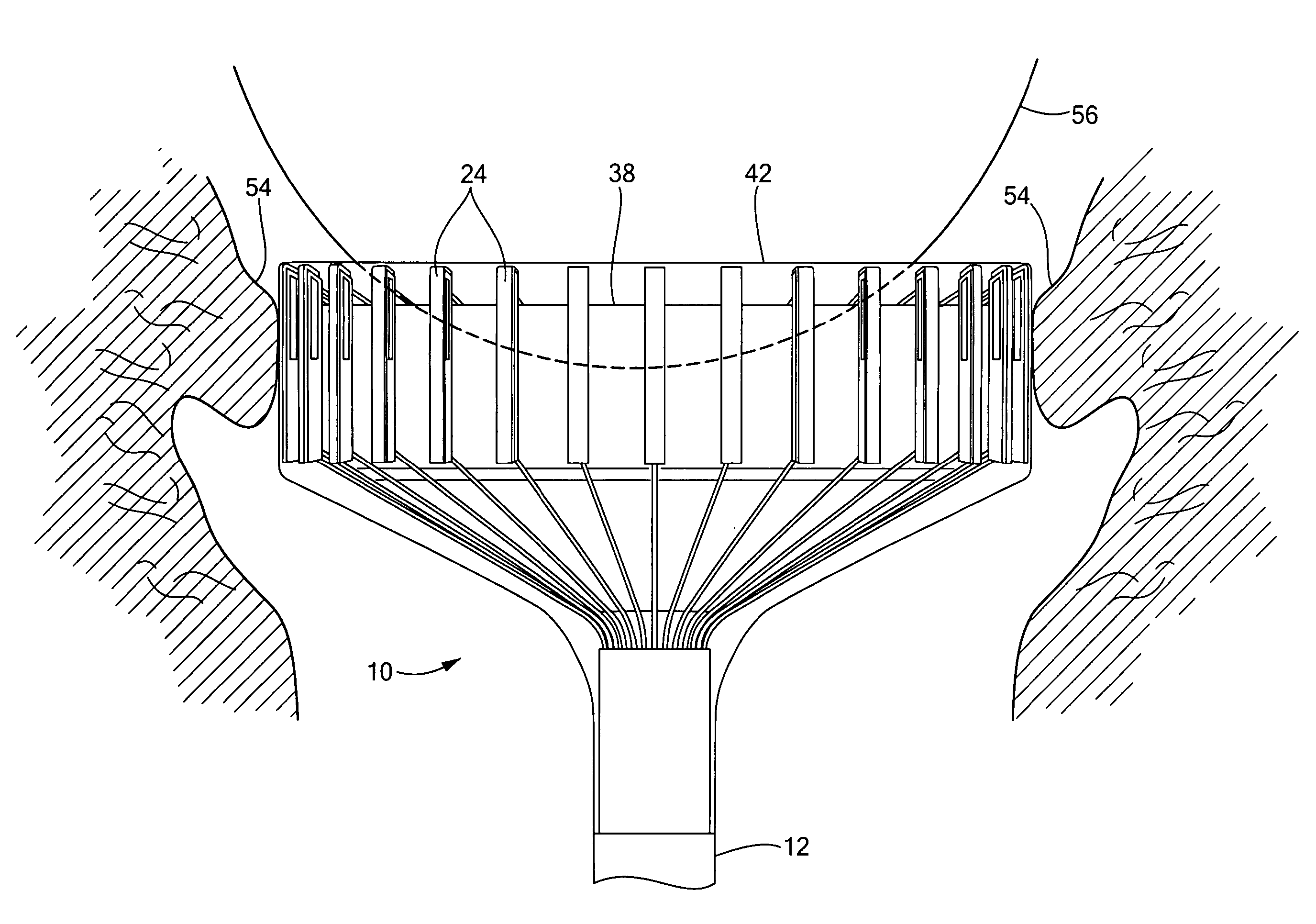 Method for cervical dilation and/or measurement