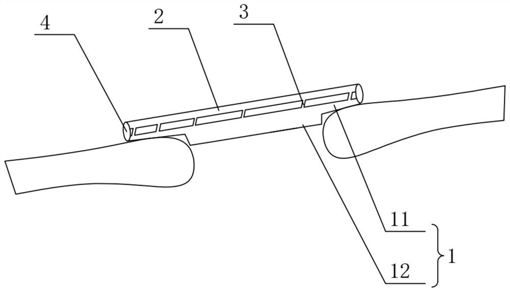 Skull prosthesis and manufacturing method of skull prosthesis