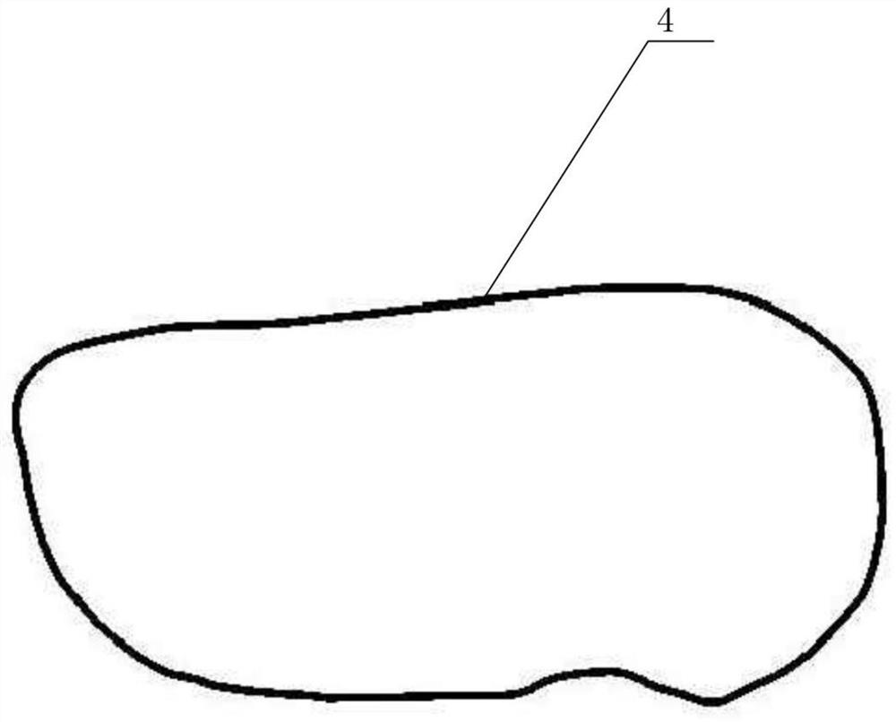 Skull prosthesis and manufacturing method of skull prosthesis