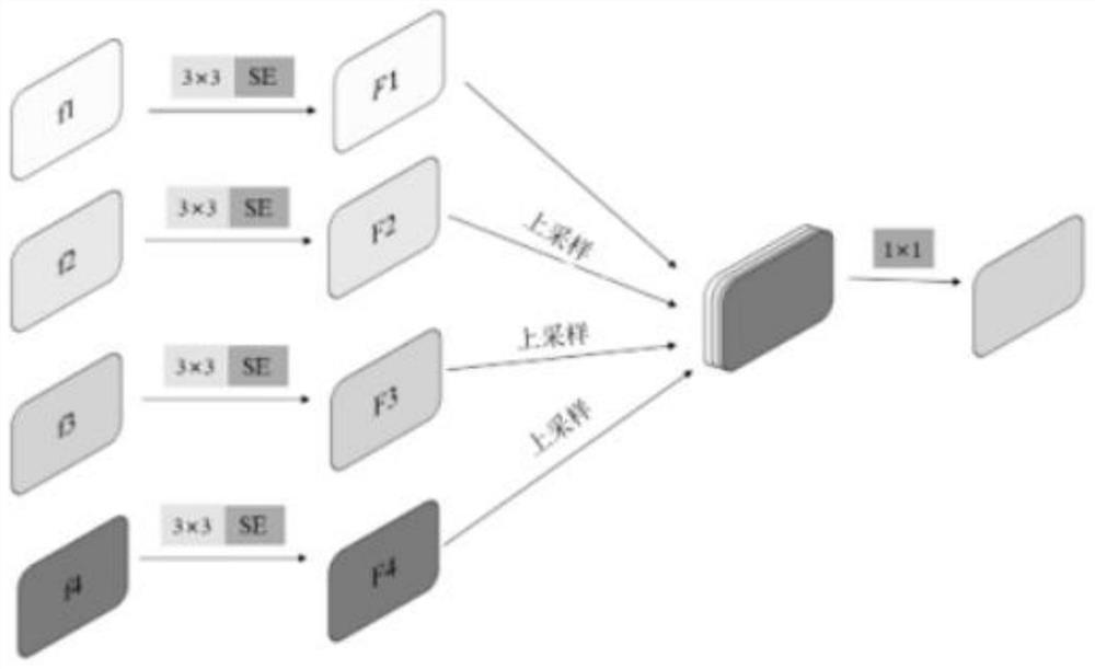 MU-Net-based intracranial hemorrhage focus segmentation algorithm applied to CT image