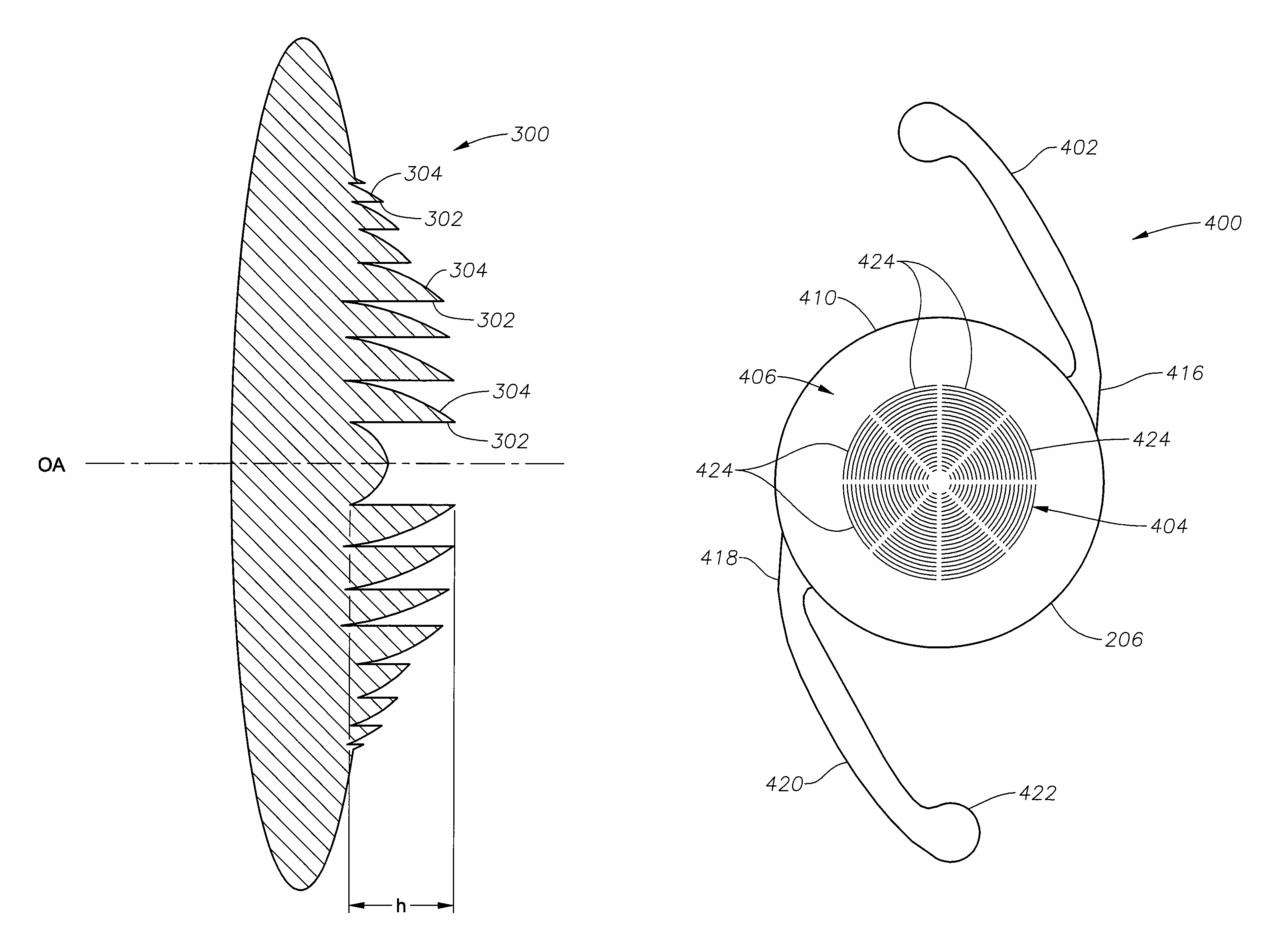 Radially segmented apodized diffractive multifocal design for ocular implant