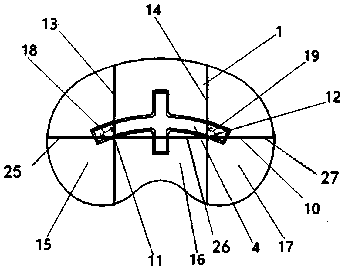 Biological-type knee joint partition bone trabecula tibial plateau