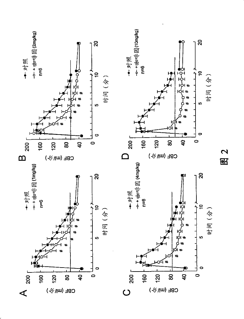 Methods and compositions for increasing patient tolerance during myocardial imaging methods