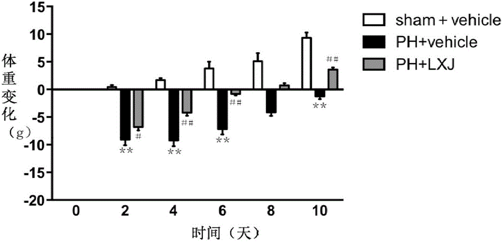 Application of resina draconis to preparation of medicine for treating acute liver injury caused by hepatectomy