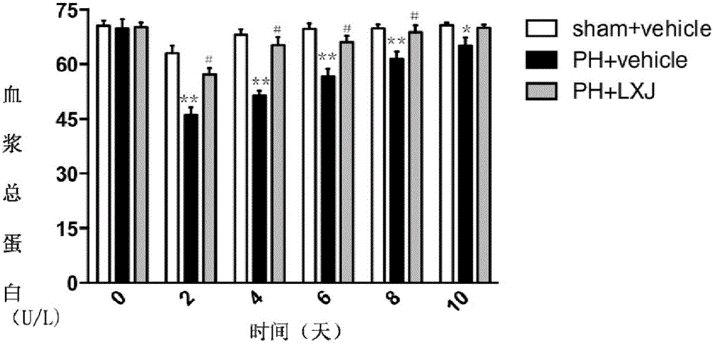 Application of resina draconis to preparation of medicine for treating acute liver injury caused by hepatectomy