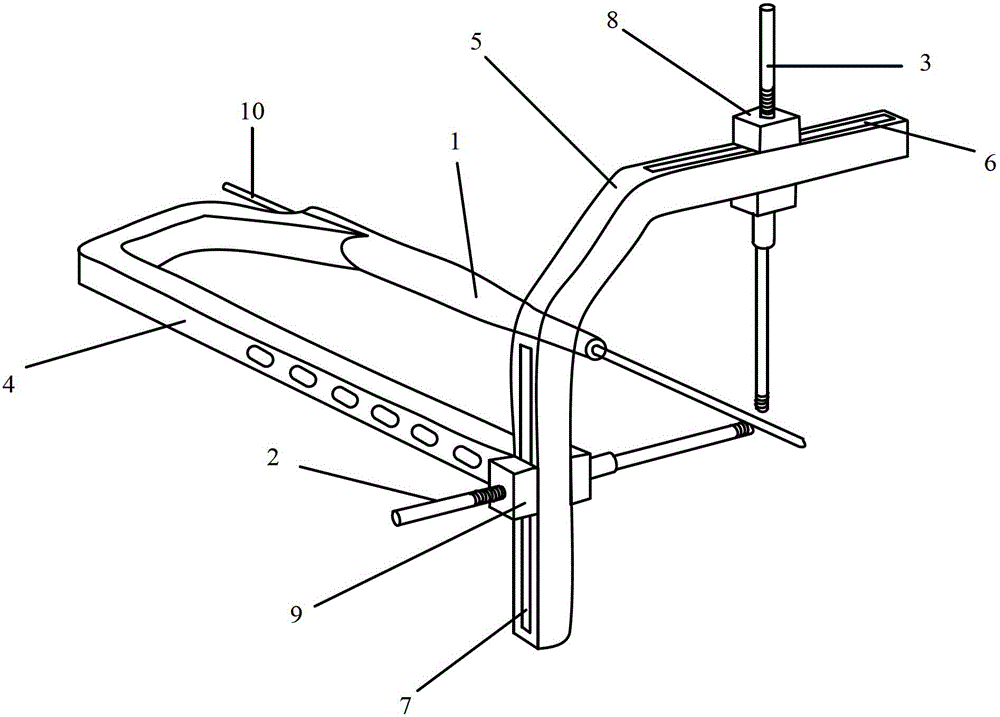 Femoral nail embedding reductor