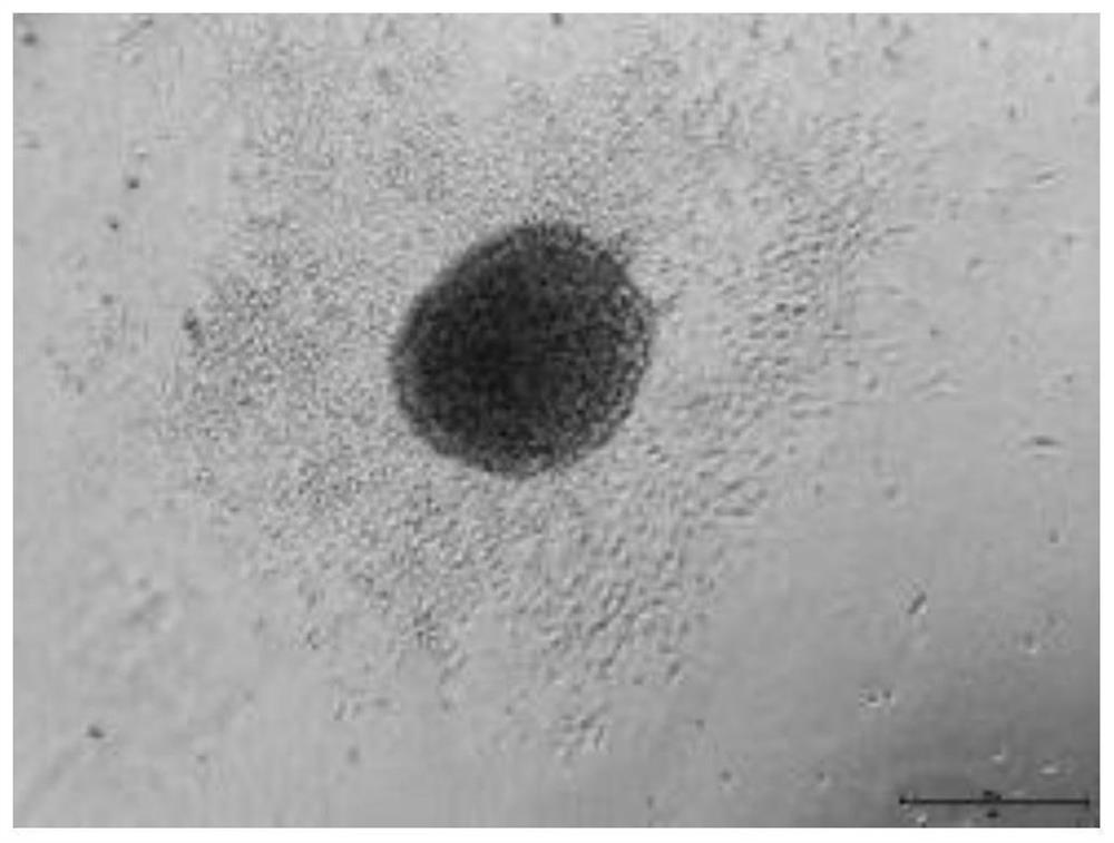 A kind of nucleus pulposus progenitor cell culture medium and its preparation method and application