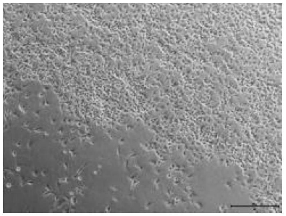 A kind of nucleus pulposus progenitor cell culture medium and its preparation method and application