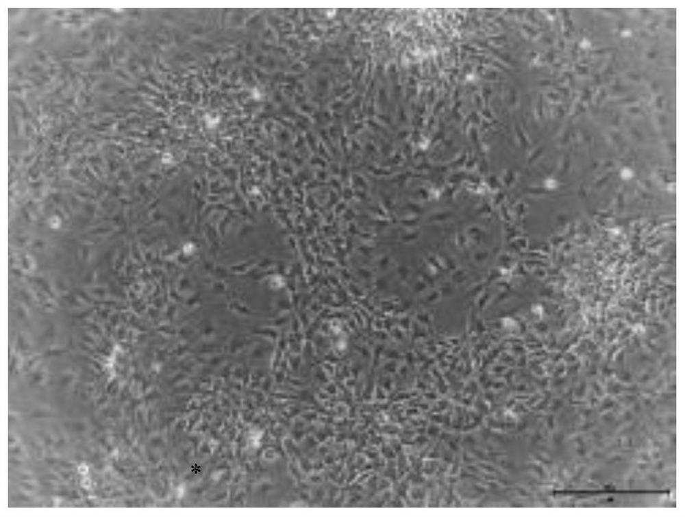 A kind of nucleus pulposus progenitor cell culture medium and its preparation method and application