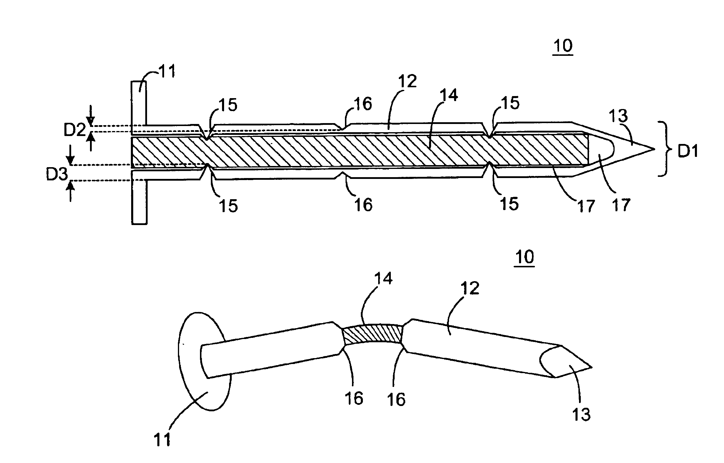 Fastener having supplemental support and retention capabilities