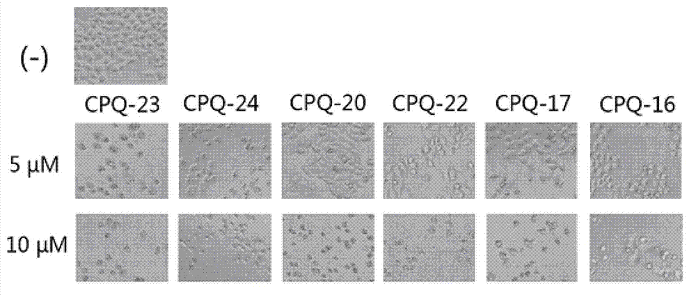 Application of dihydrochromone skeleton compound in preparation of medicine for treating malignant tumors