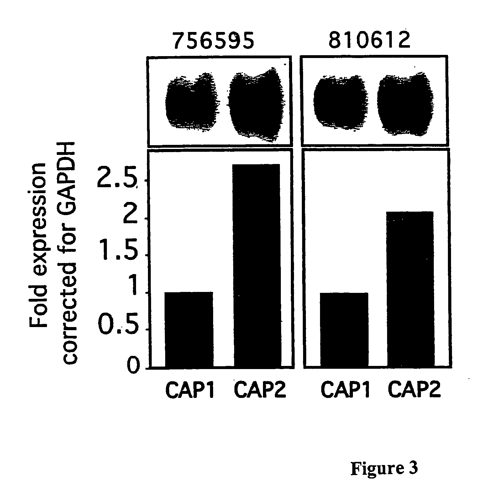 Methods for predicting and overcoming resistance to chemotherapy in ovarian cancer and for predicting colon cancer occurrence