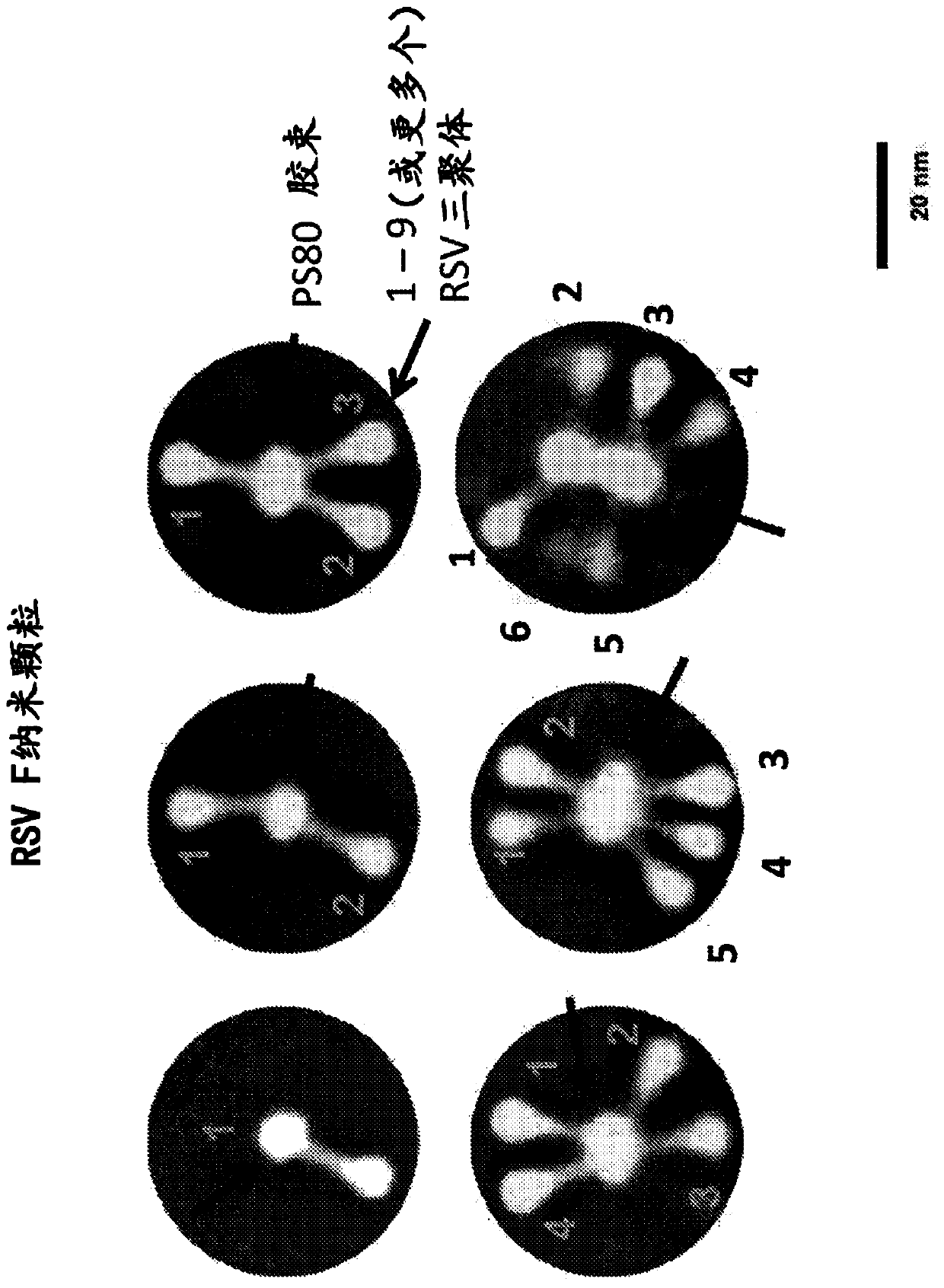 Methods and compositions for treating respiratory disease