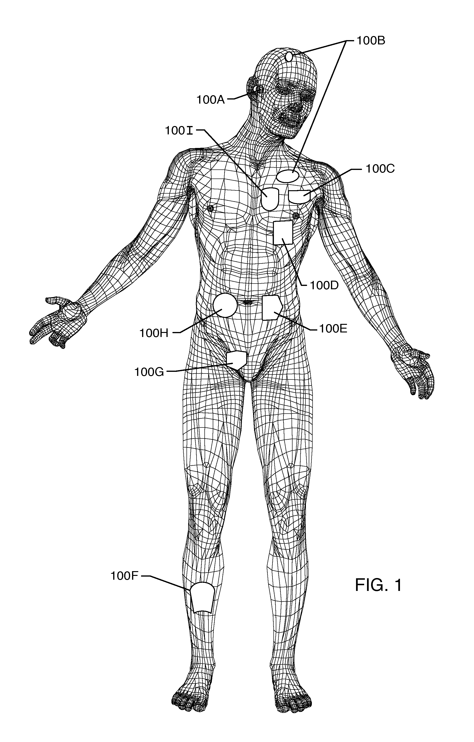 Electromagnetic interference filter and method for attaching a lead and/or a ferrule to capacitor electrodes