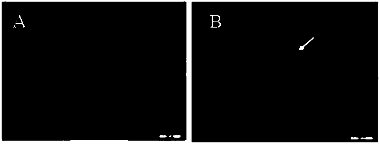 Modified human lactoferrin gene suitable for bombyx mori silk gland expression as well as expression system adopting modified human lactoferrin gene and applications