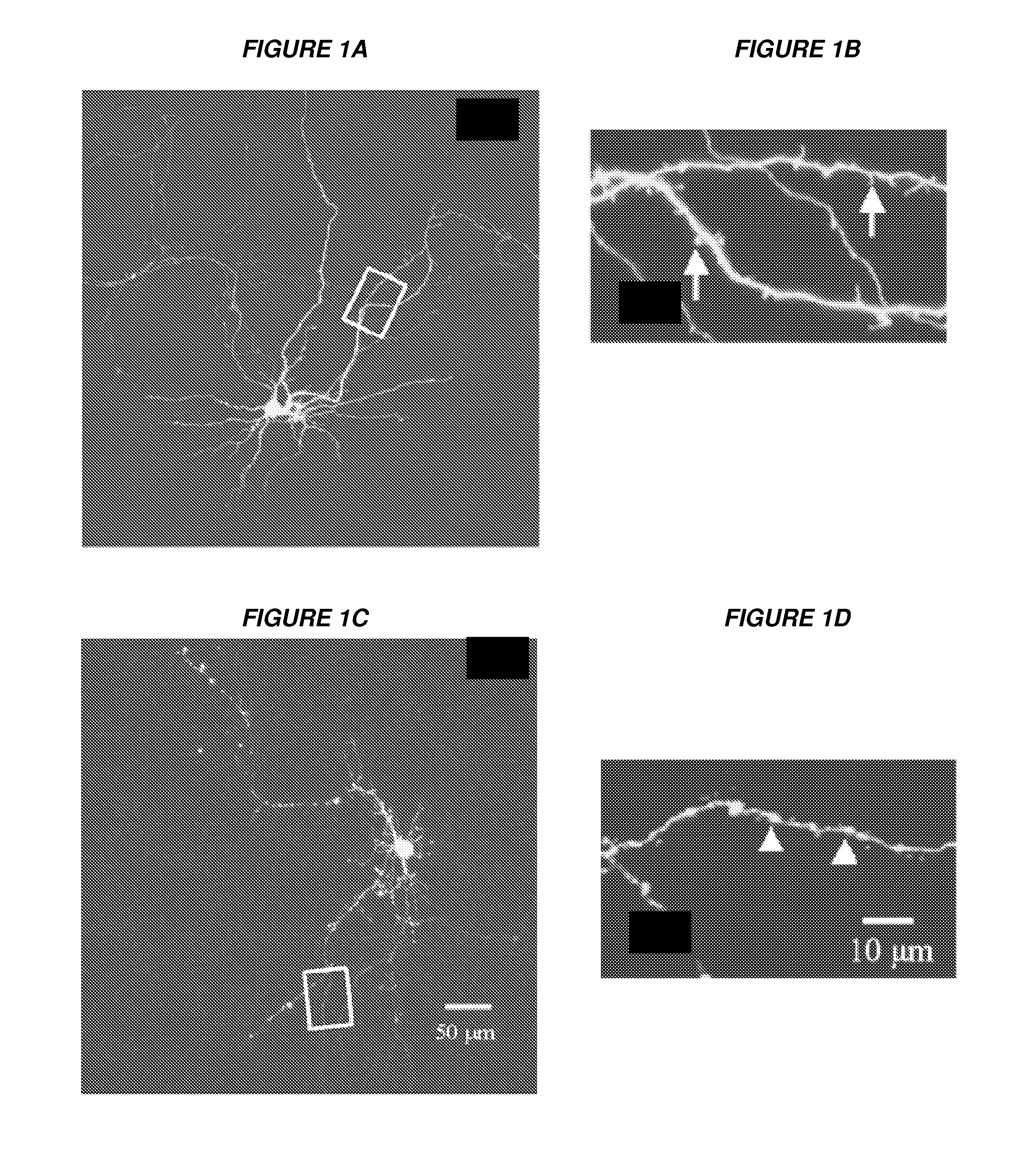 Methods to inhibit neurodegeneration