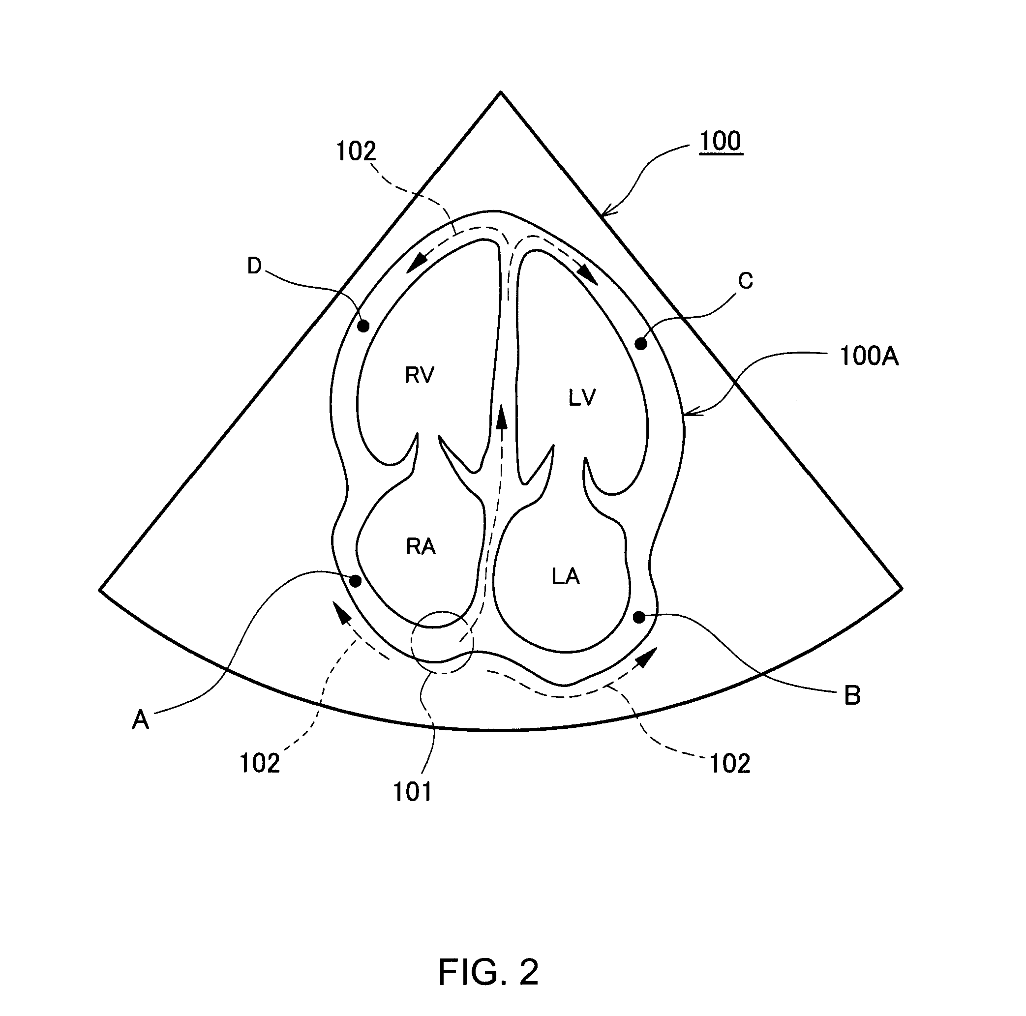 Ultrasonic diagnostic apparatus