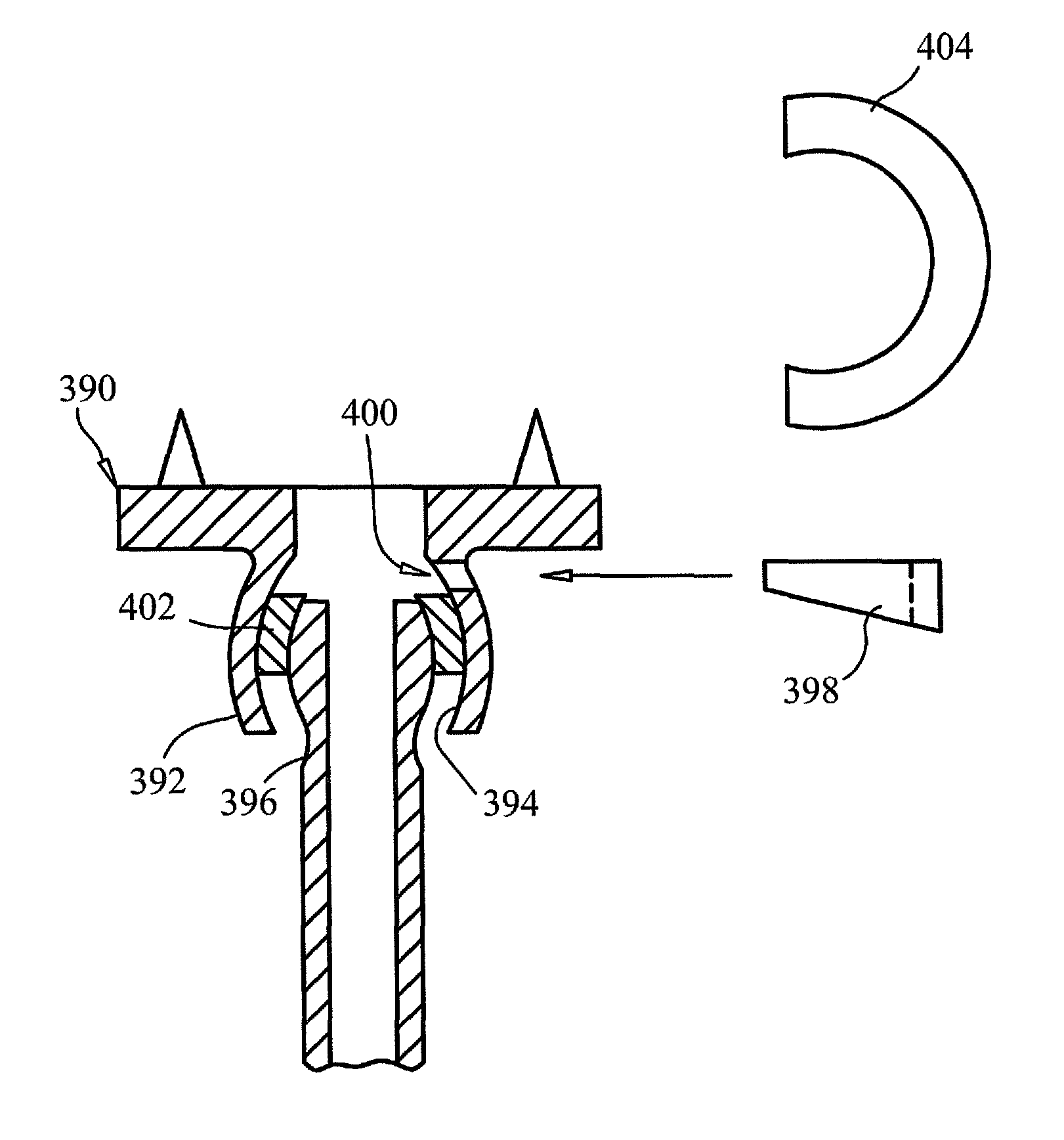 Expandable vertebral prosthesis