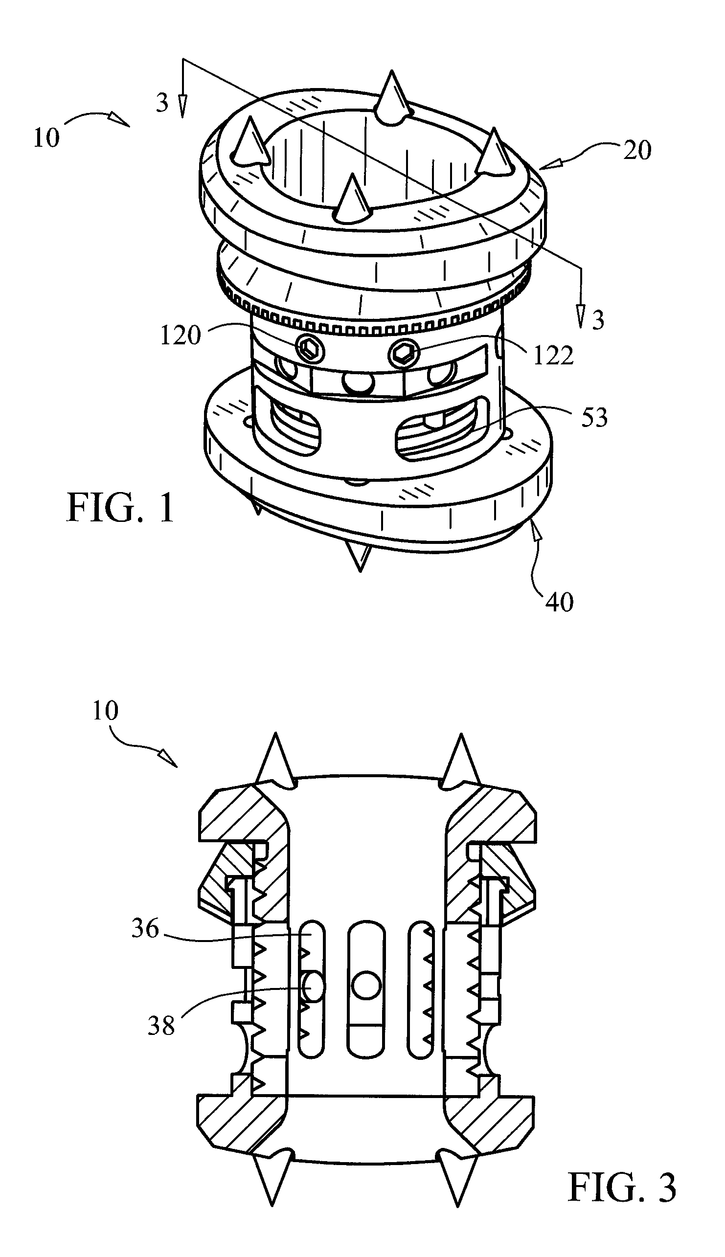 Expandable vertebral prosthesis