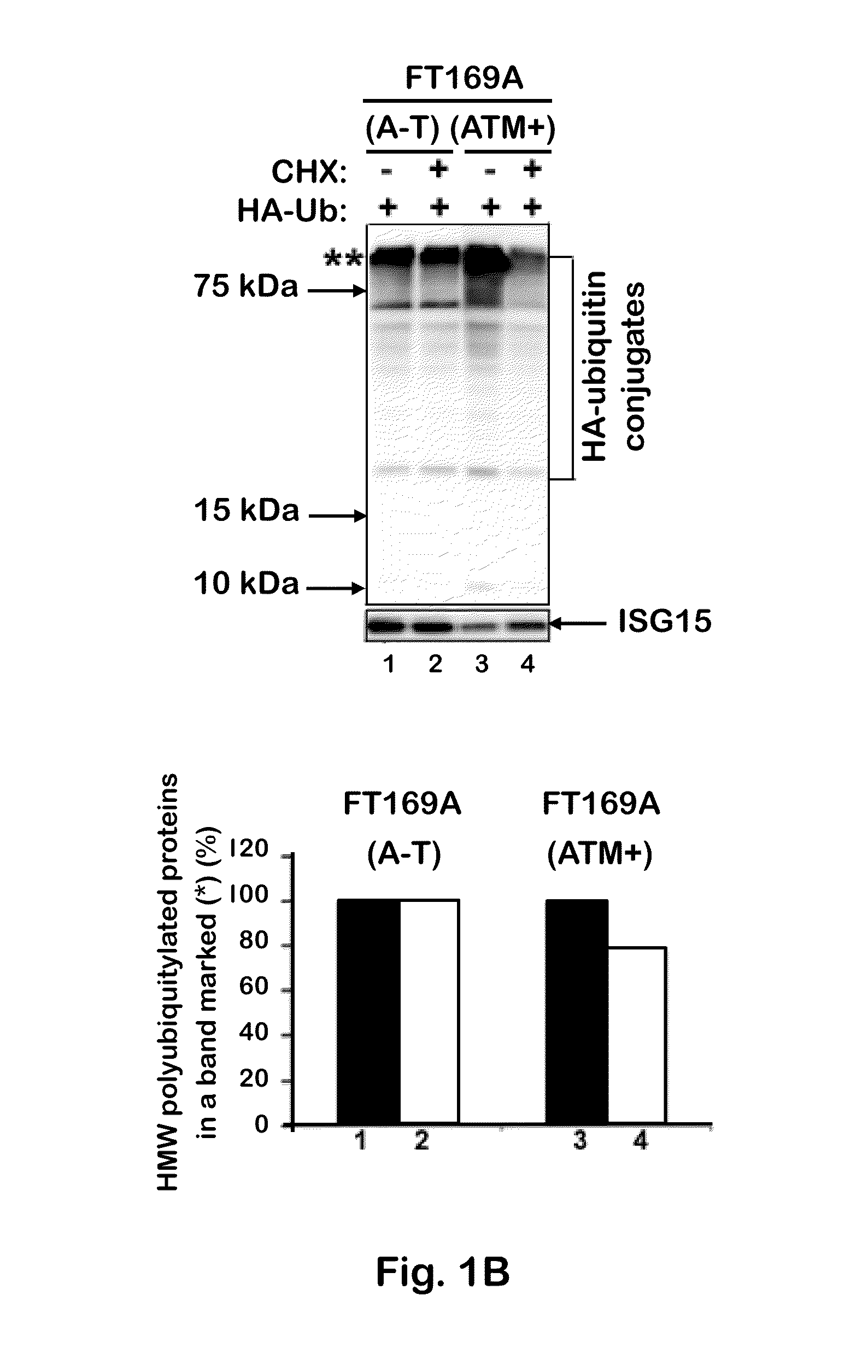 Therapeutic and Diagnostic Method for Ataxia-Telangiectasia