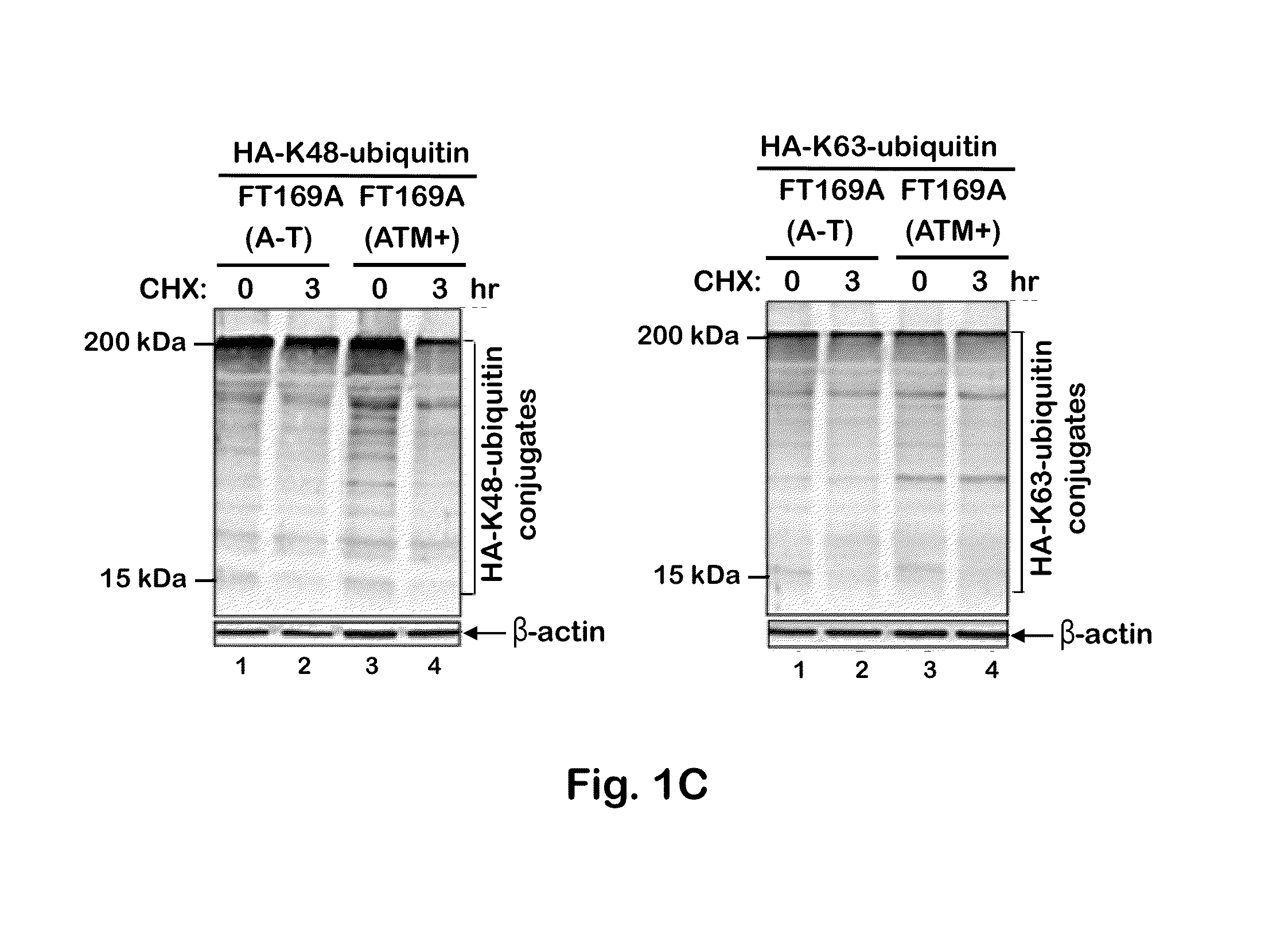 Therapeutic and Diagnostic Method for Ataxia-Telangiectasia