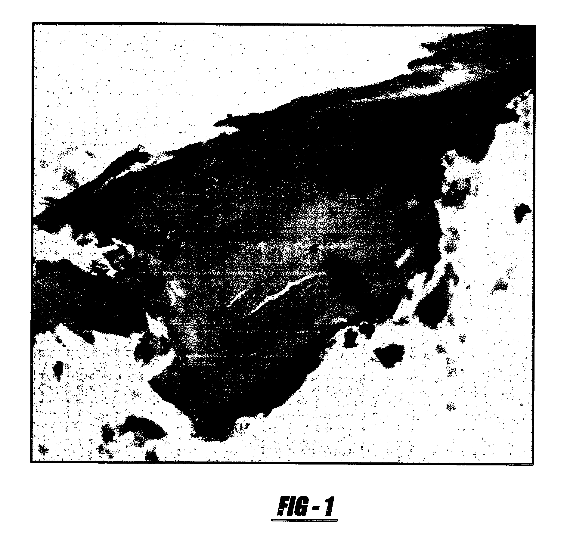 Device for collecting bone material during a surgical procedure