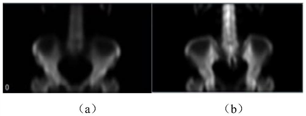 A method and system for reconstructing a bone tomographic image