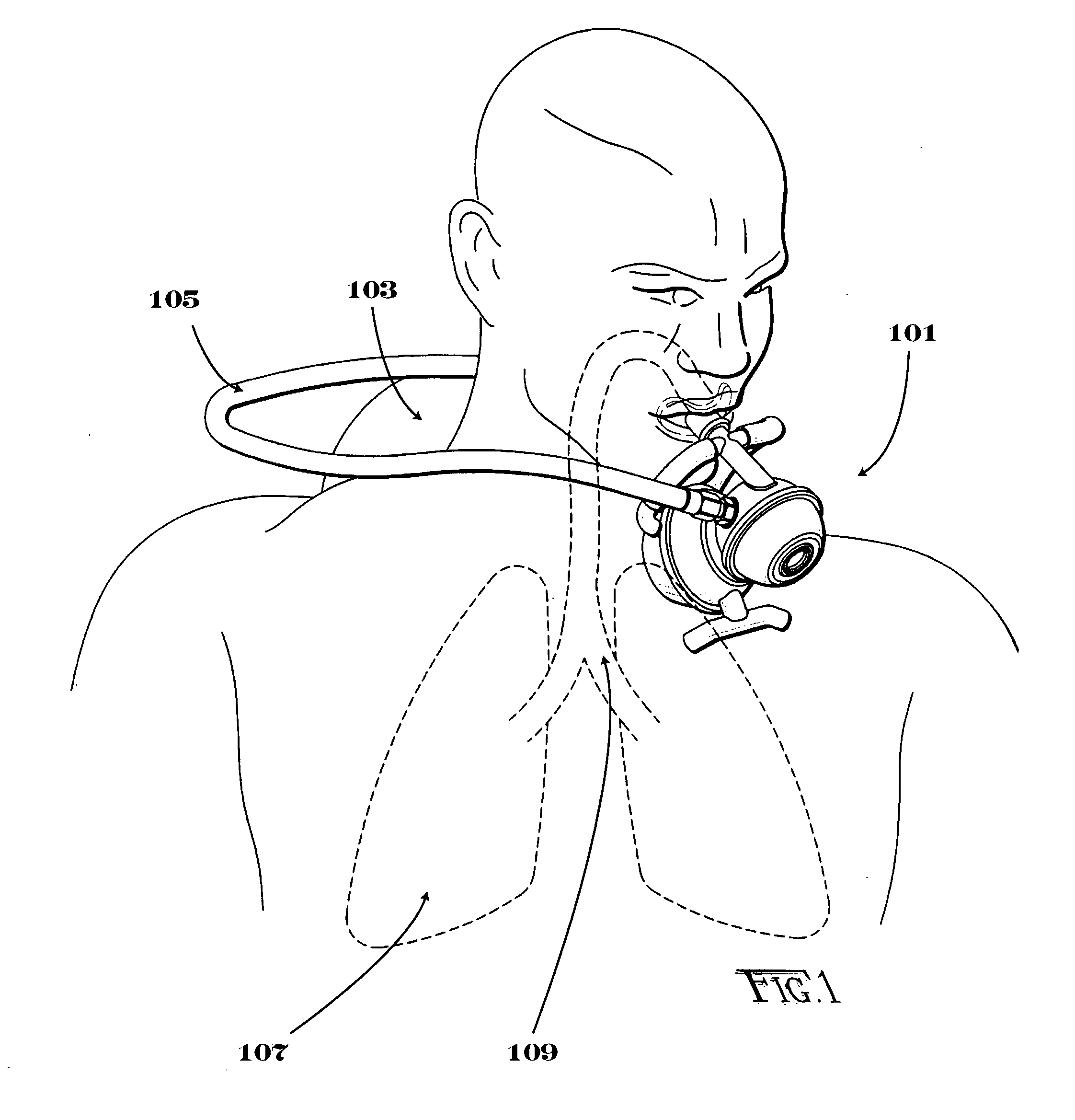 Second stage regulator