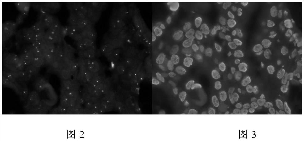 Cell nucleus segmentation method and system for fluorescence in situ hybridization images