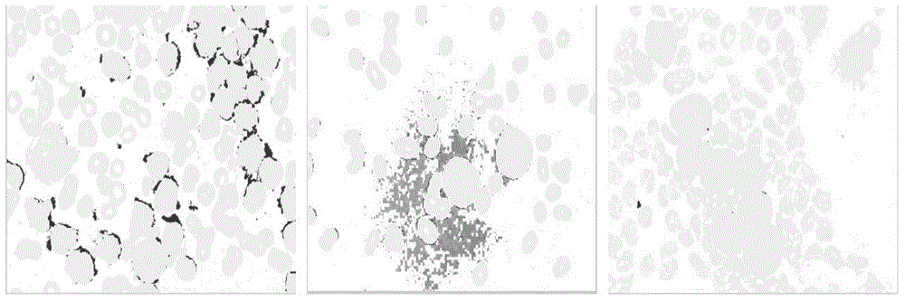 AML cell segmentation method based on Meanshift cluster and morphological operations