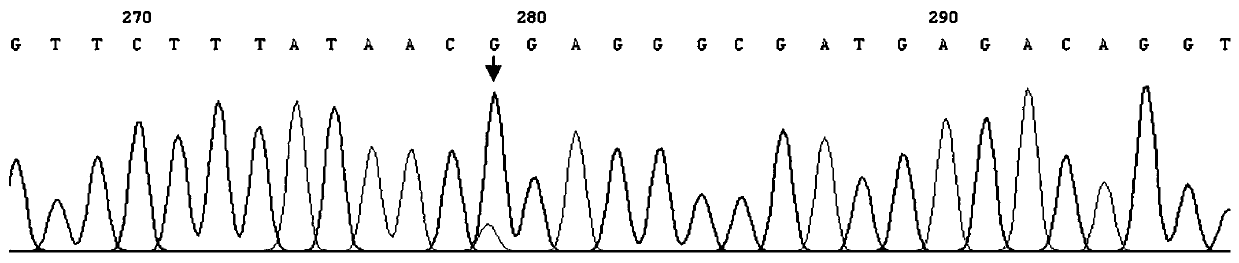 Kit for DIAPH1 mutation detection, a pathogenic gene of delayed sensorineural hearing loss