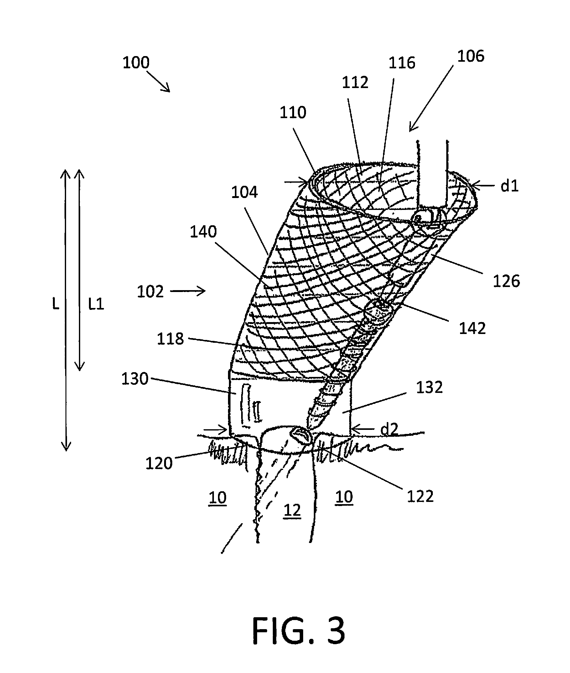 Surgical Devices for Access to Surgical Sites