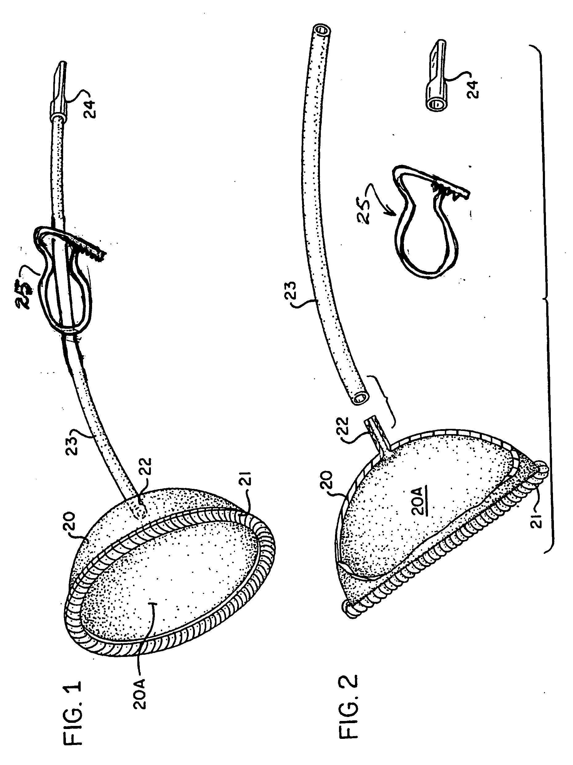 Breast tissue expanding device