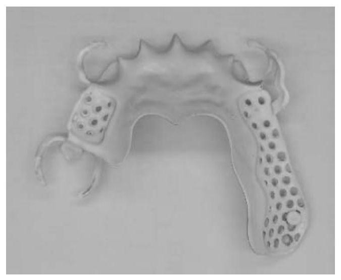 Whitening and self-cleaning coating of surface of titanium alloy dental prosthesis and preparation method of coating