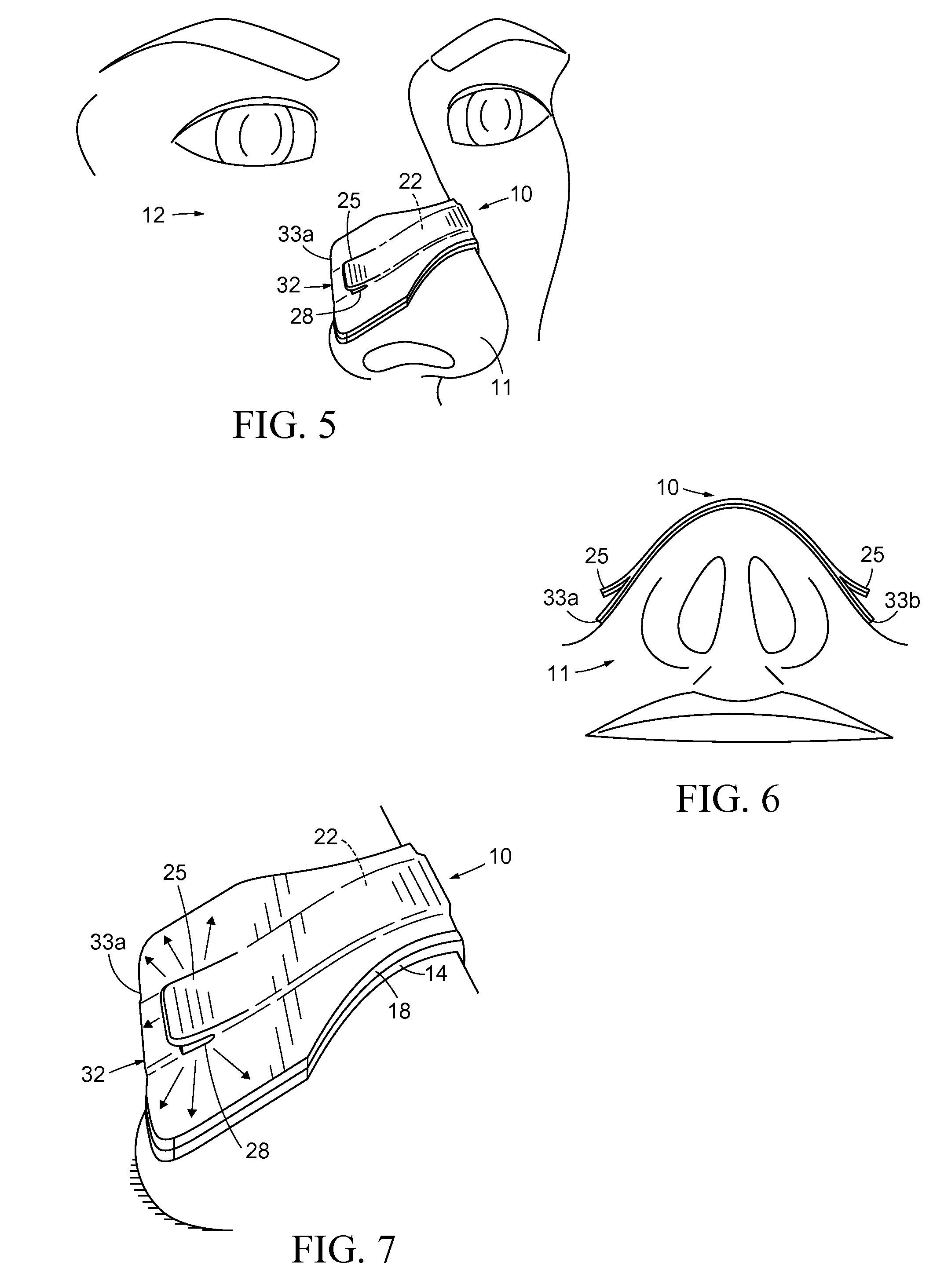 Nasal dilator with means to direct resilient properties