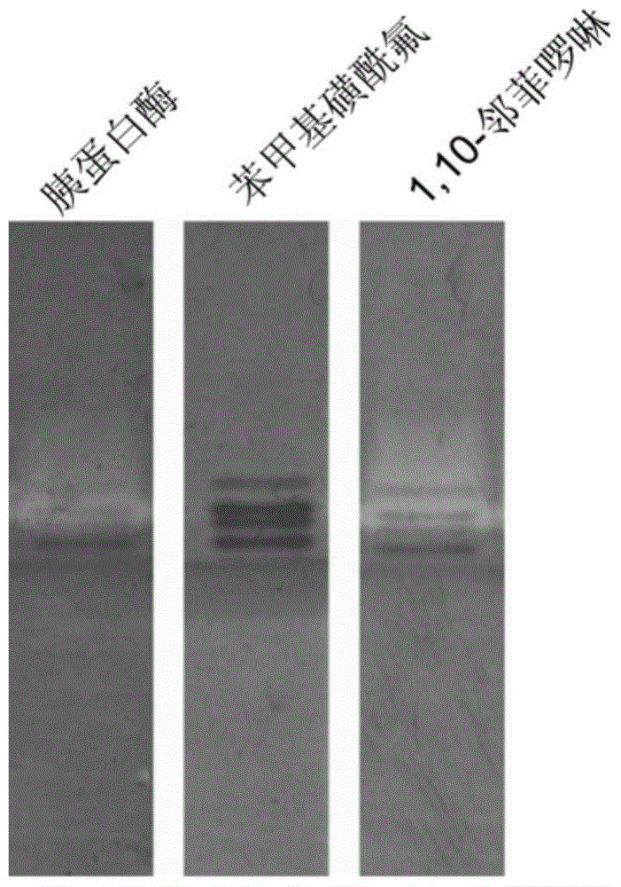 Application of a Protease Spectrum Electrophoresis Detection Method in Rapid Identification of Bacterial Extracellular Proteases