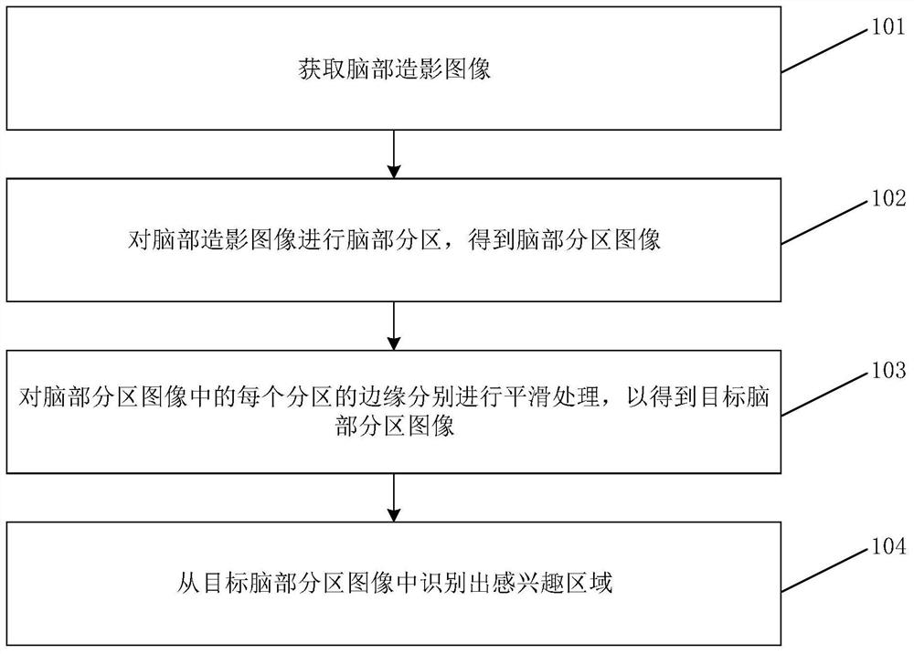 Brain contrast image processing method and device, medium and electronic equipment